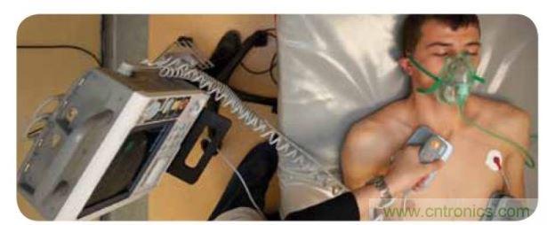 帶電極的醫院用除顫器。注意，患者身上有外部心電圖或心臟監護儀，從胸部的白色圓片(電極)和導聯(線)可看出來。