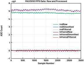 動態離散周期變換技術突破：無ECG參考的生理信號精準解析